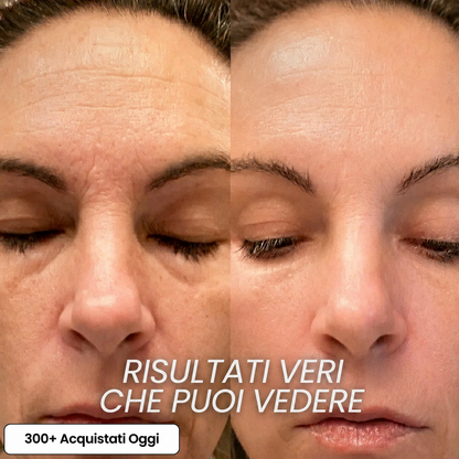 Stick Rimpolpante Bio-Collagene PDRN