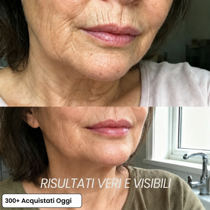 Stick Rimpolpante Bio-Collagene PDRN