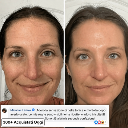 Stick Rimpolpante Bio-Collagene PDRN